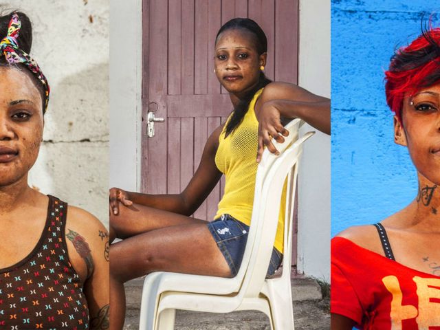 Asian Porn Star Creams Black - Skin Bleaching - How and Why These Black Women Bleach Their Skin