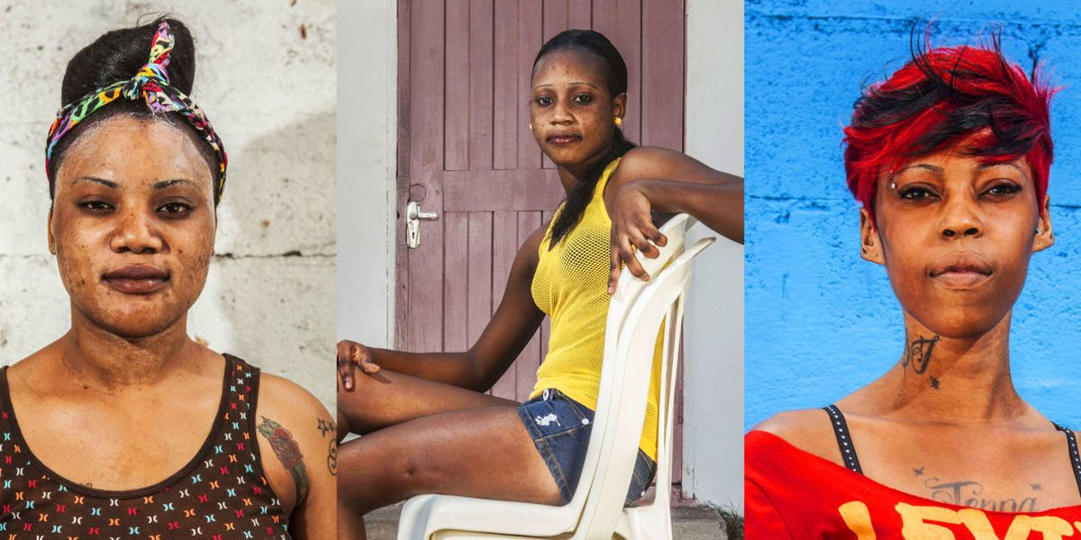 Why Black Women in a Predominately Black Culture Are Still Bleaching Their Skin