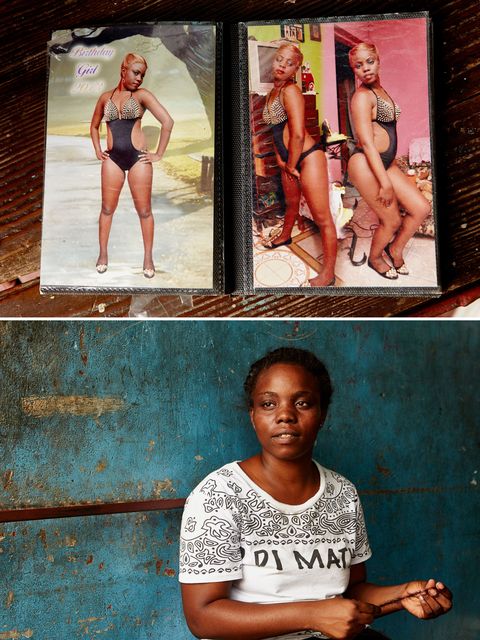 Thick Jamaican Women Porn - Skin Bleaching - How and Why These Black Women Bleach Their Skin