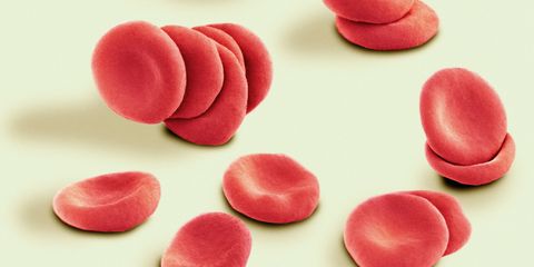 Stacked red blood cells, coloured scanning electron micrograph (SEM). These stacks of red blood cells, known as 'rouleaux', are abnormal and symptomatic of an underlying disease or condition.