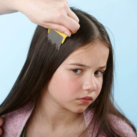 using a nit comb to find headlice 