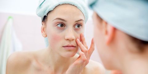 Woman touching her face after cleansing skin