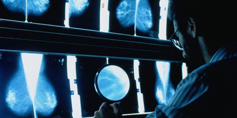 Male radiographer sat at light box studying mammograms
