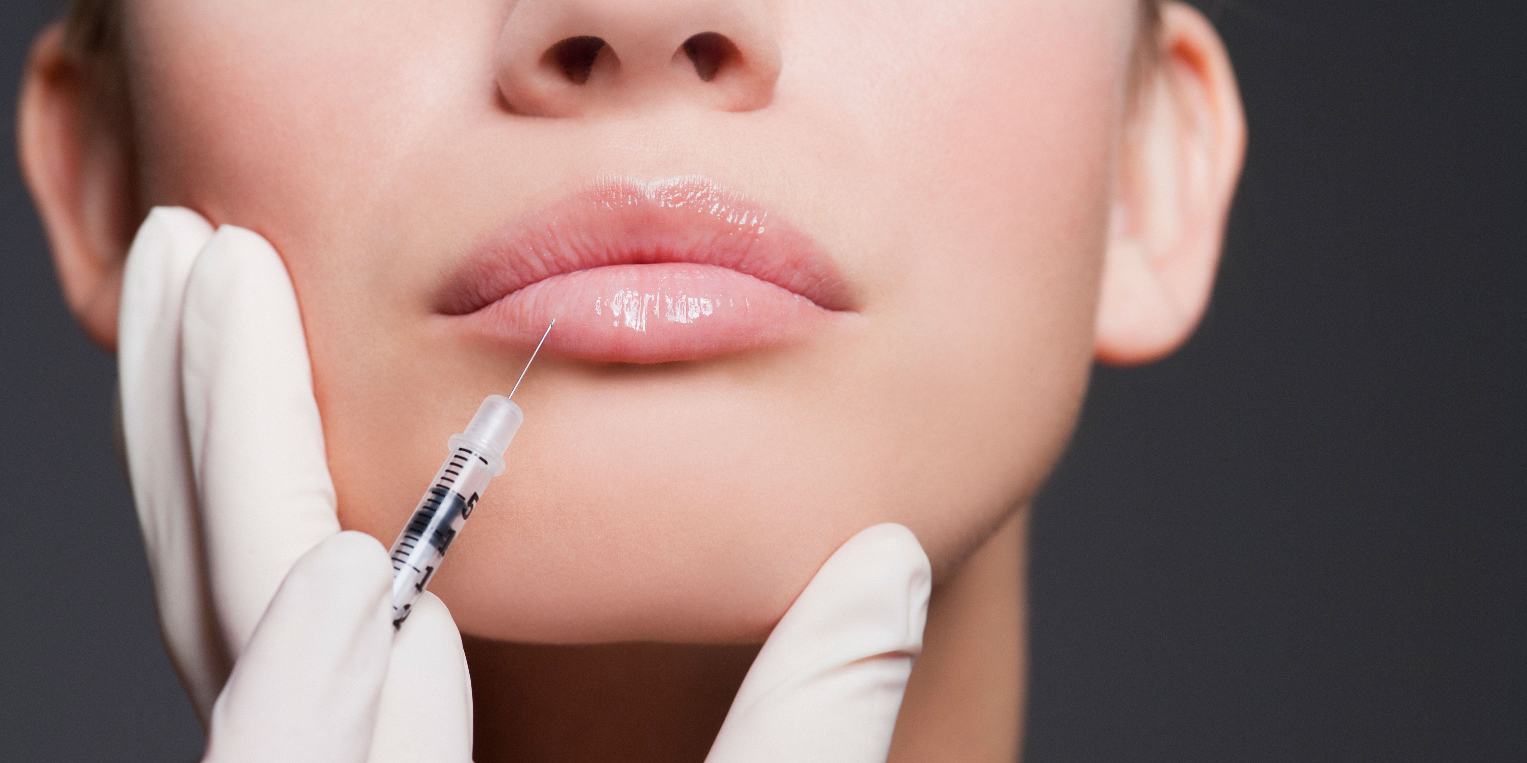 What you need to know about lip fillers