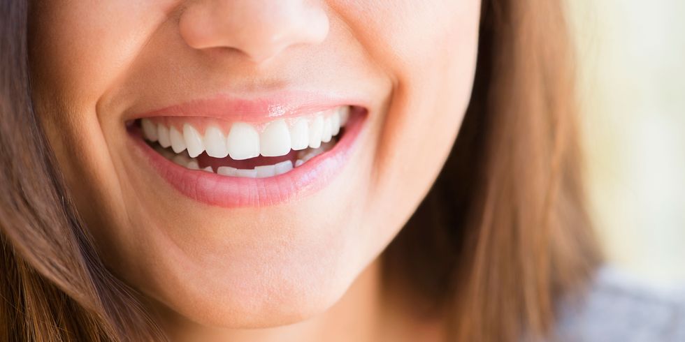Woman smiling teeth