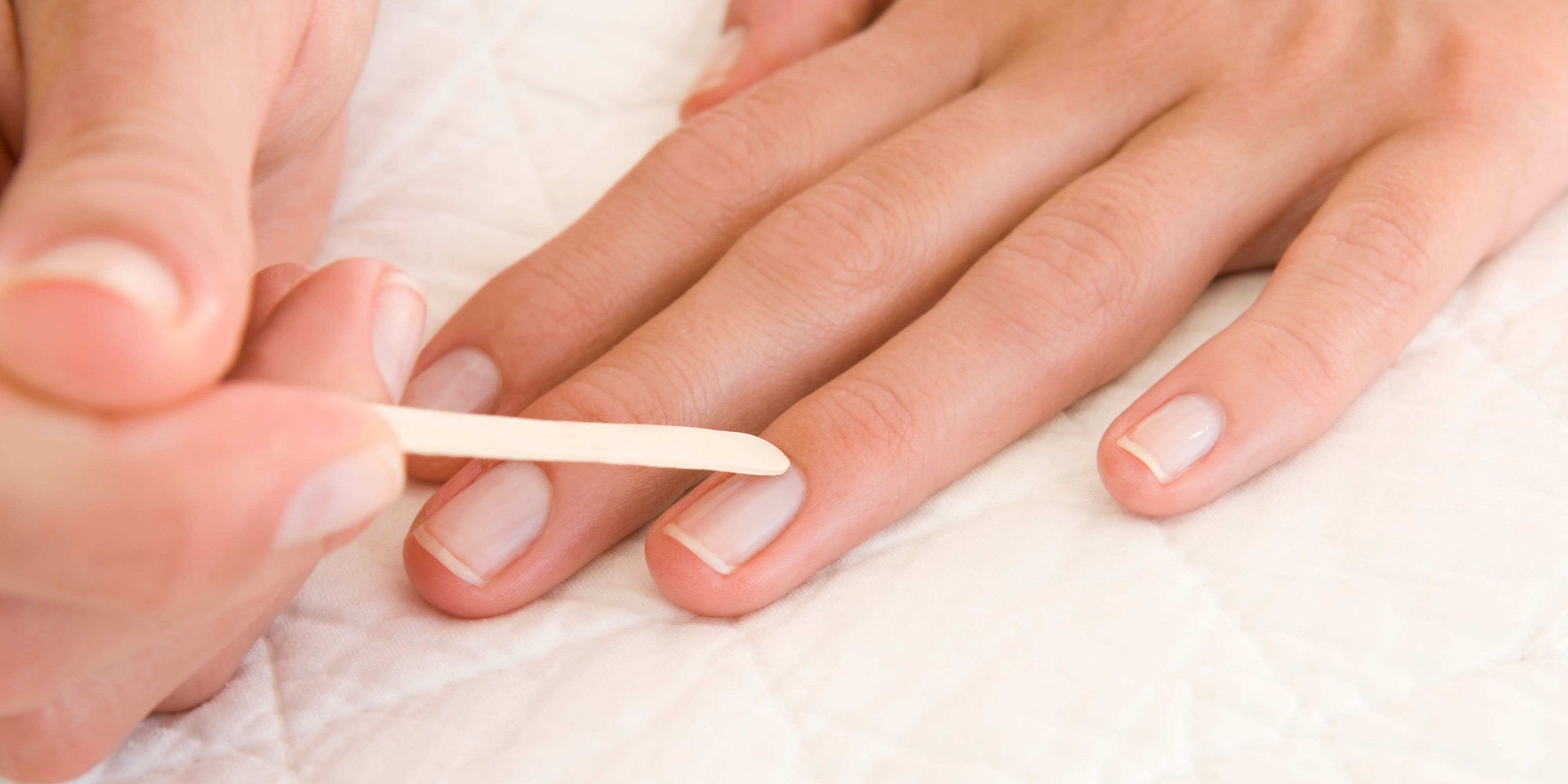 All Natural Nails - Your fingernails can reveal a lot about the state of  your health. Conditions ranging from stress to kidney and thyroid disease  can cause changes in your nails. One
