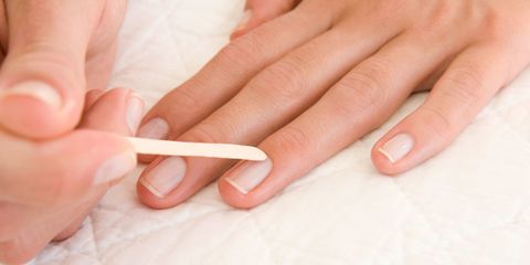 Brittle Spoon Shaped Nails 