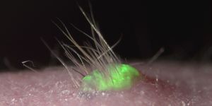 Transplantation of the bioengineered, 3D integumentary organ system using mouse iPS cells labeled with GFP