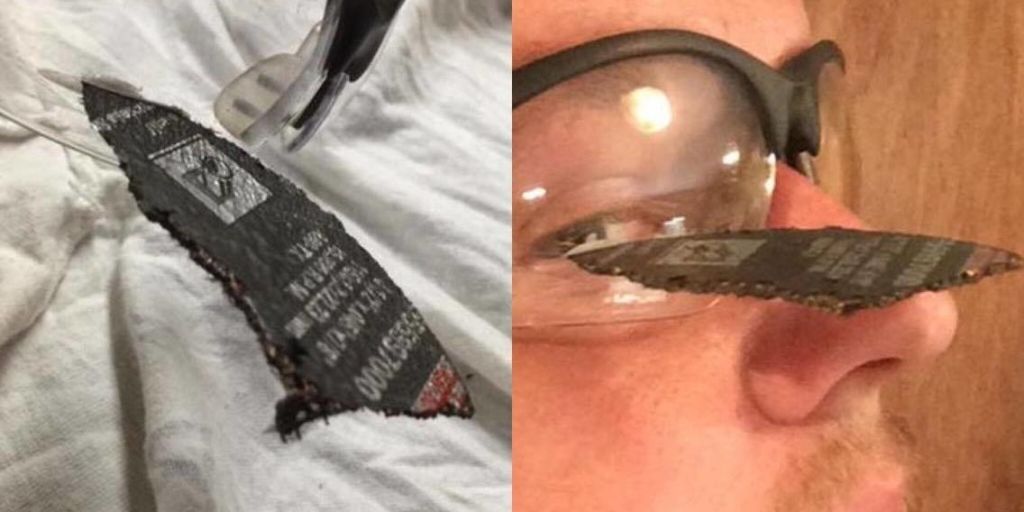 Here Is Why You Wear Safety Glasses