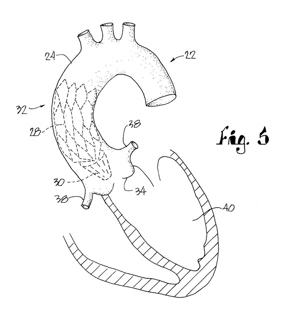 patent-figure.jpg
