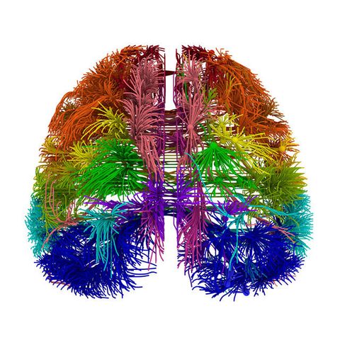  A top-down 3-D view of the cortico-connections originating from multiple distinct cortical areas, visualized as virtual tractography using Allen Institute Brain Explorer software.