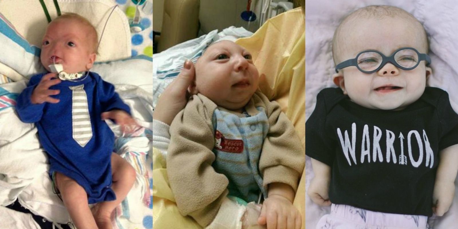 10 Stories Of Miracle Babies - Incredible Miracle Baby Stories