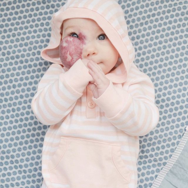 Sleeve, Skin, Textile, Child, Baby & toddler clothing, Toddler, Baby, Bonnet, Peach, Portrait photography, 