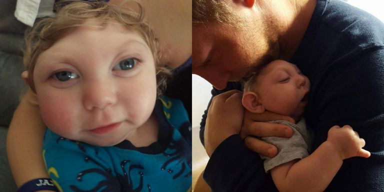 Jaxon Strong, Miracle Baby Born With Most of His Skull Missing, Just ...