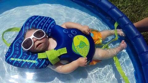Jaxon Strong, Miracle Baby Born With Most of His Skull Missing, Just ...