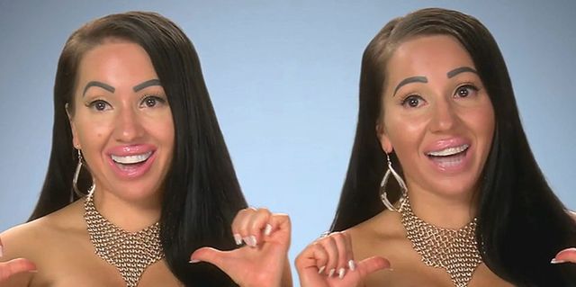 Identical twins on Botched