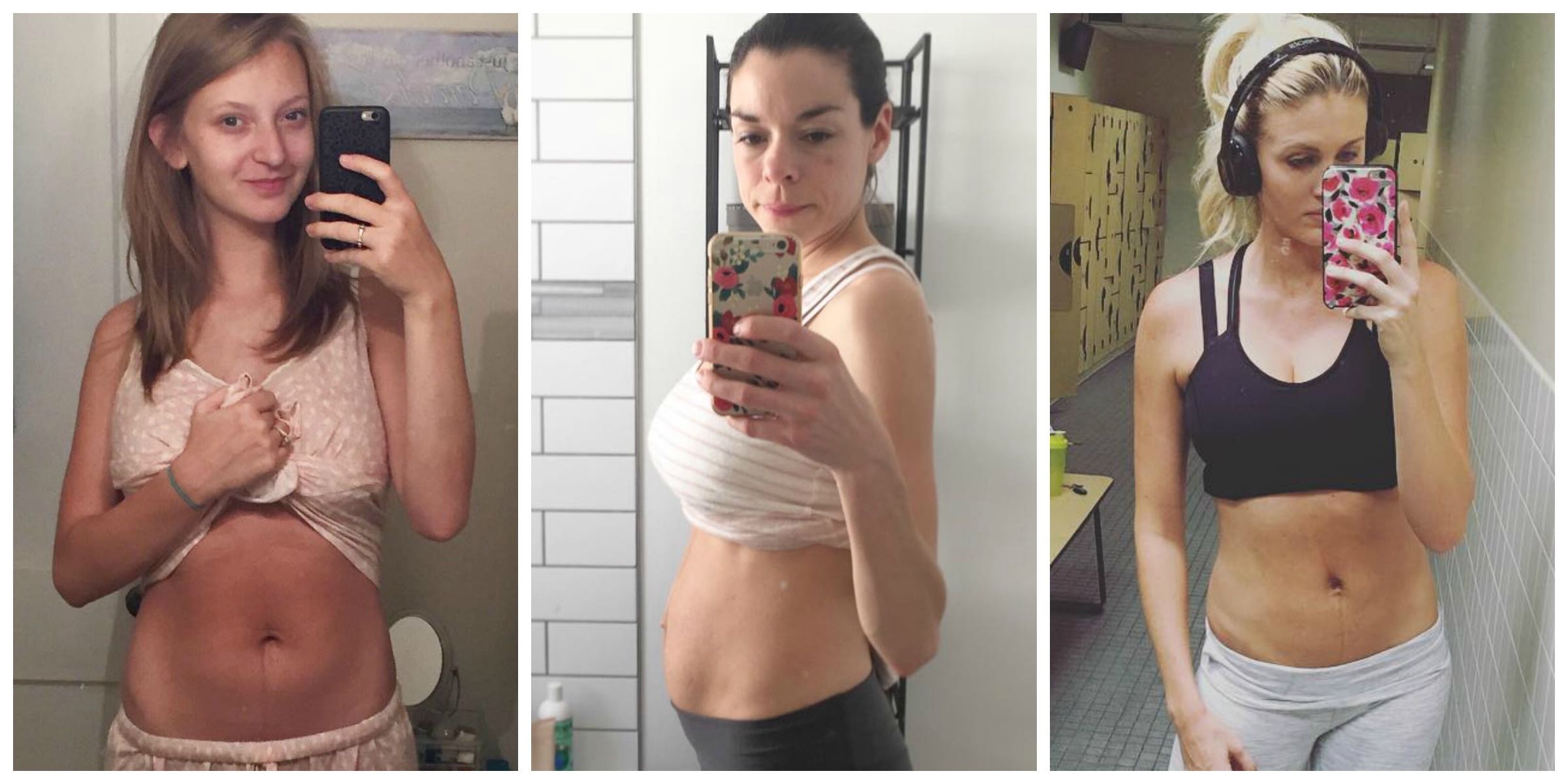 New Moms Get Really Real About Their Post Baby Bodies