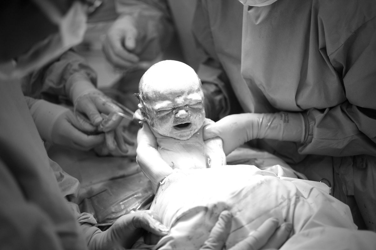 baby born during c section