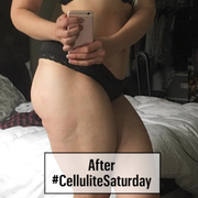 cellulite saturday