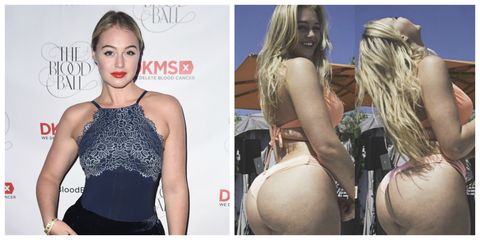 <p>The blonde bombshell has long&nbsp;been adamant about not retouching any of her Instagram photos. She's shared plenty of real AF&nbsp;body positive <a href="http://www.redbookmag.com/body/mental-health/news/a48379/iskra-lawrence-says-fat-rolls-are-beautiful/" target="_blank" data-tracking-id="recirc-text-link">pictures of her stomach rolls</a>, stretch marks, and more.&nbsp;</p><p>But you can really feel the self-love <a href="https://www.instagram.com/p/-KMm1hLk-f/?hl=en " target="_blank" data-tracking-id="recirc-text-link">in one super cute bikini picture</a>, where she pointed out that she hadn't airbrushed away&nbsp;her "tiger stripe stretch marks," "cellulite lightning bolts," or her back fat.&nbsp;"You are more than your body and you get to decide what beauty is," Lawrence wrote in her caption. Preach!</p>