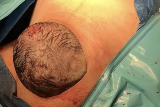 This Incredible C-Section Video Will Either Make You Faint or Cry