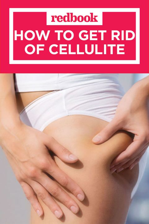 How To Get Rid Of Cellulite On Thighs Legs And Butt Cellulite Removal Treatments