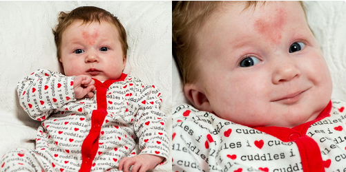 Baby Conceived on Valentine's Day Born With Heart-Shaped Mark on Her Forehead