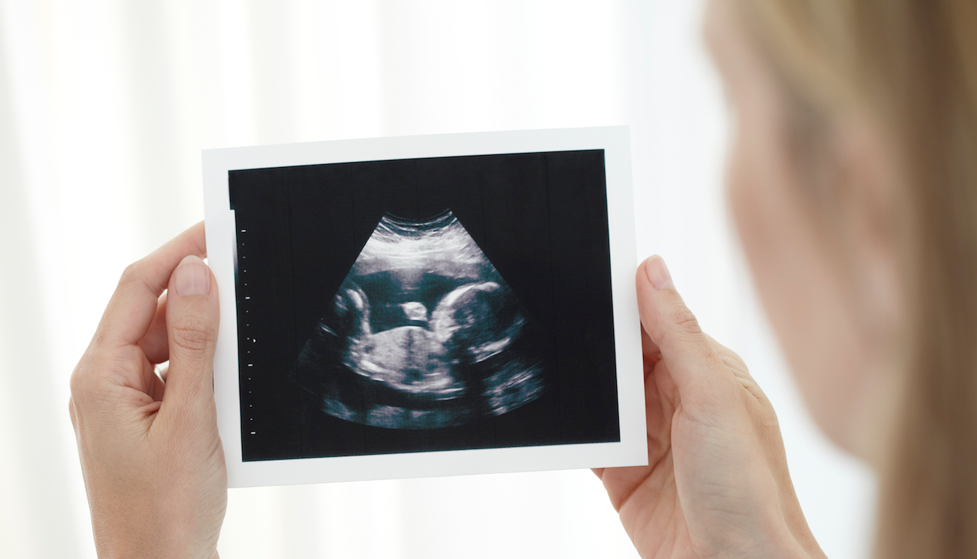 Baby Flashes Peace Sign In Hilarious 4D Ultrasound Picture