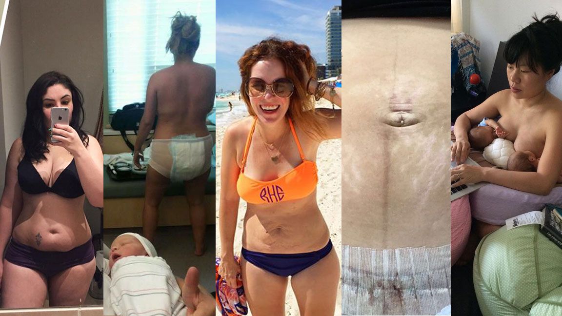 Mom goes viral sharing reality of her postpartum body - Good