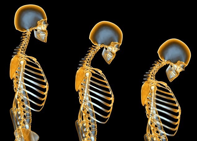 Yellow, Amber, Skeleton, Metal, Bone, Human anatomy, Symmetry, Rib, Silver, Brass, 
