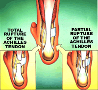 Human leg, Text, Joint, Knee, Font, Elbow, Organ, Human anatomy, Bone, String instrument accessory, 