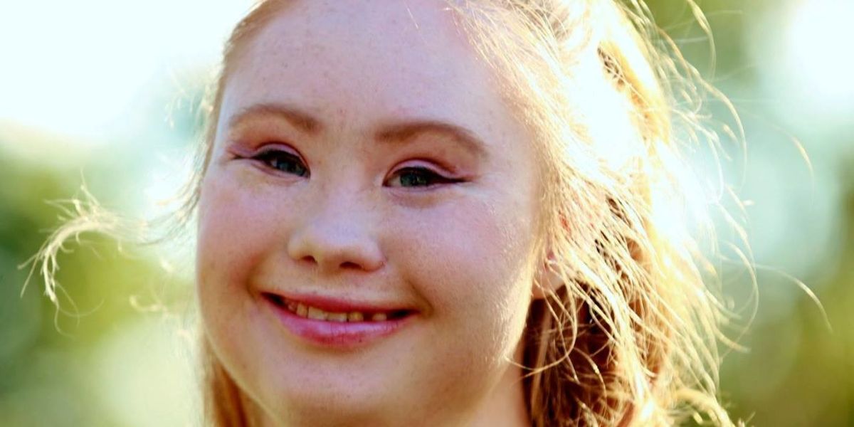 The Inspiring Teen With Down Syndrome Is Now A Legit Model