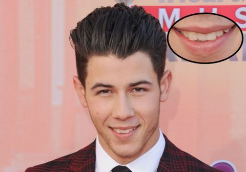 The CrAzY Thing You Never Noticed About Nick Jonas' Teeth