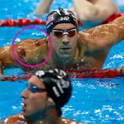 michael phelps cupping