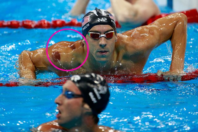 michael phelps cupping