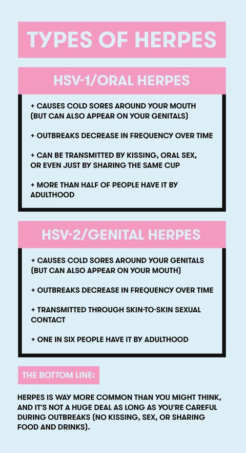 herpes type 1 in mouth