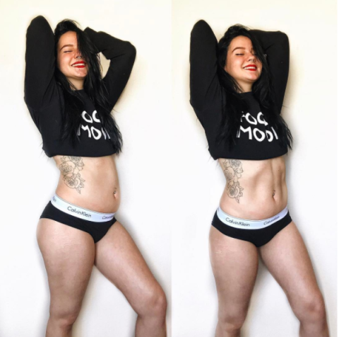 Before And After Weight Gain Photos
