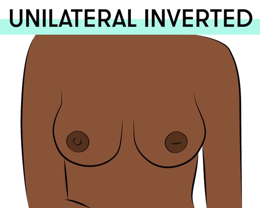 The 8 Nipple Types in the World - Different Areola Sizes and Shapes