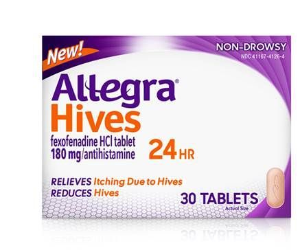 Allegra Hives