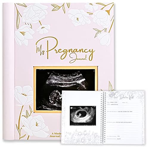 65 Best Gifts for Pregnant Women 2022