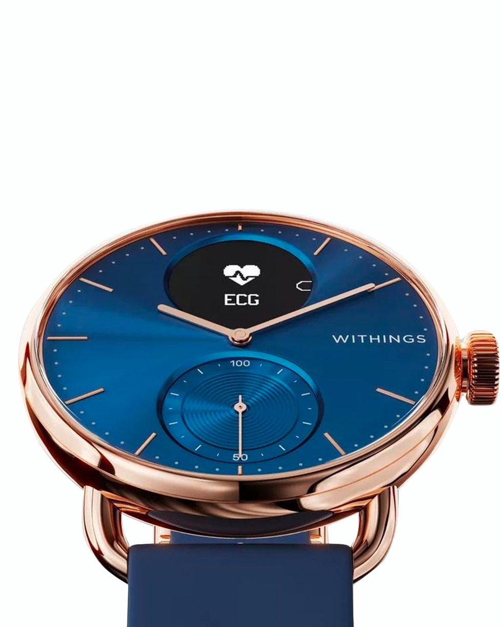 ScanWatch