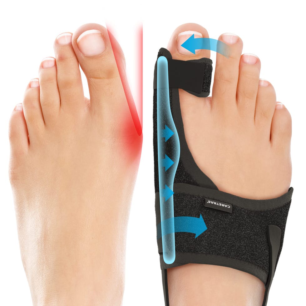Bunion Corrector