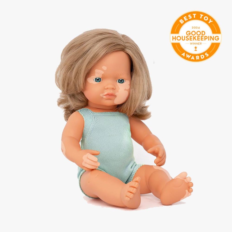 Doll with Vitiligo