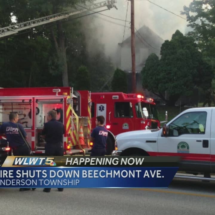 Man S Hands Burned In Beechmont Ave Fire