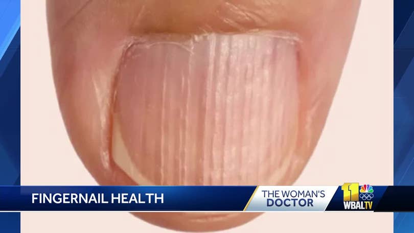 Pin on Fingernail health