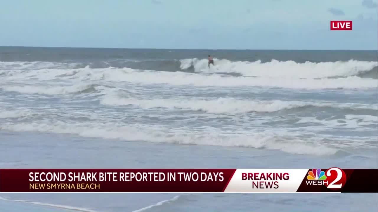 Teenage Surfer Bitten On Hand By Shark In New Smyrna Beach