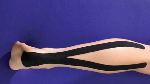 preview for Achilles Tendinitis Treatment Using Kinesio Tape