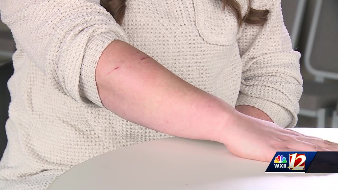 Woman and family members attacked by rabid fox in Mount Airy