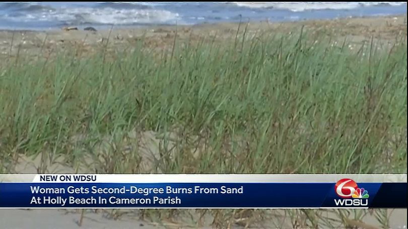 Woman Burns Feet While Visiting Louisiana Beach