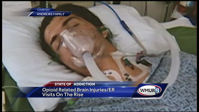 Anoxic Brain Injury Survivor Stories